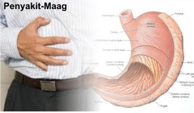 Minum Madu Pahit Sebelum Makan Perbaiki Saluran Pencernaan