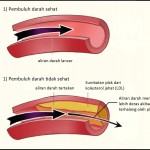 Bebas Kolesterol dengan madu pahit