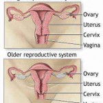 Menopause Dini Gejala dan cara mengatasinya